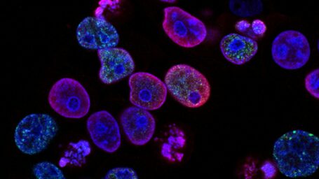 Colorectal Cancer Cells