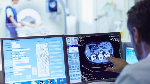 Doctor looking at an MRI Image