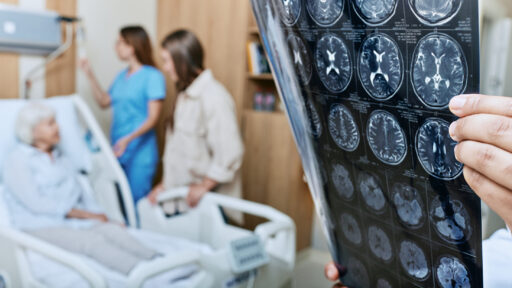 Doctor looking at a brain scan