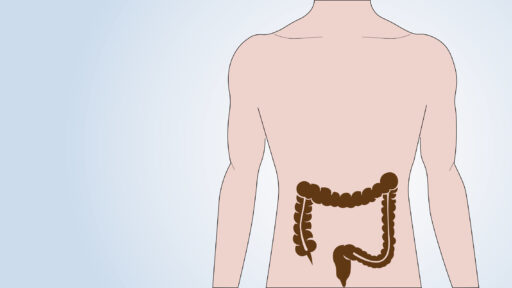 Anal Cancer Treatment