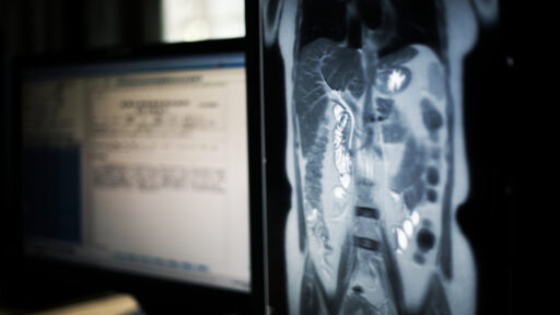 Bile Duct Cancer Treatment
