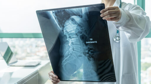 Bone Cancer