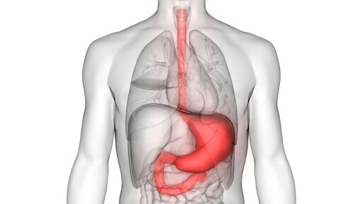 Gastric Cancer Treatment