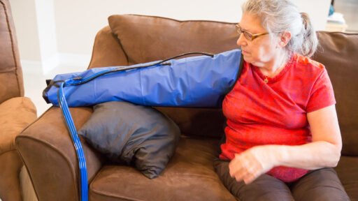 Lymphedema