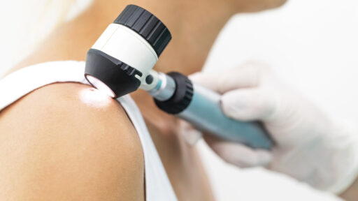 melanoma treatment