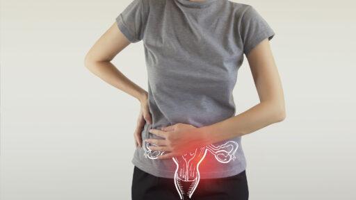 Ovarian Cancer