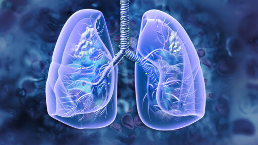 Lung Cancer