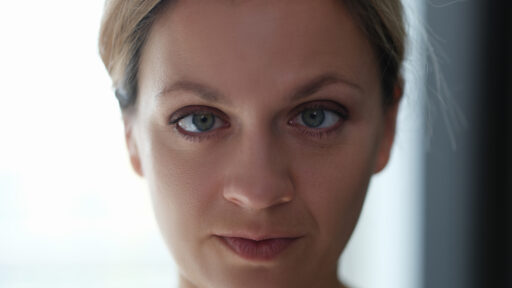 Adult Strabismus