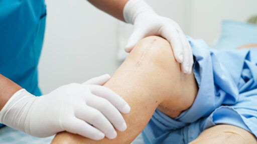 patient with a knee replacement