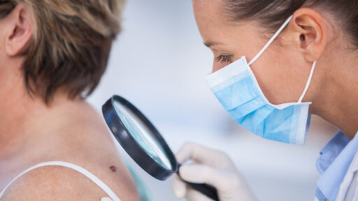 Doctor checking a patient for skin cancer