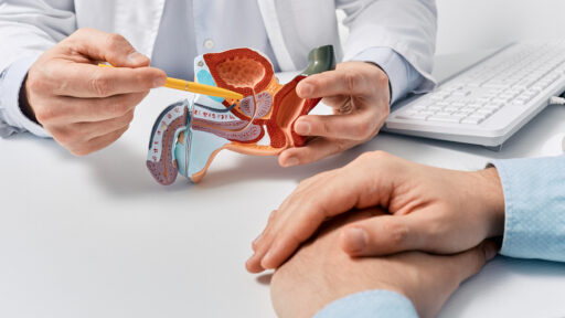diagram of the prostate