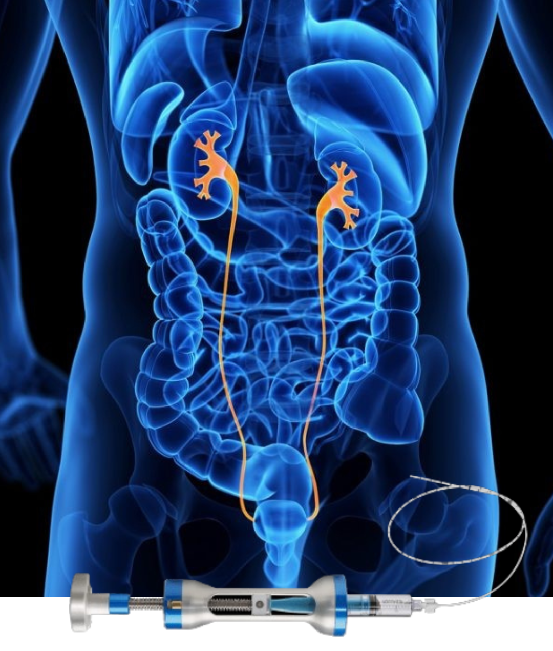 A depiction of the Jelmyto
device and how it works