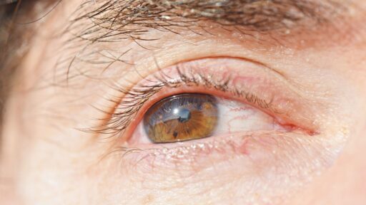 Eye disease UAMS