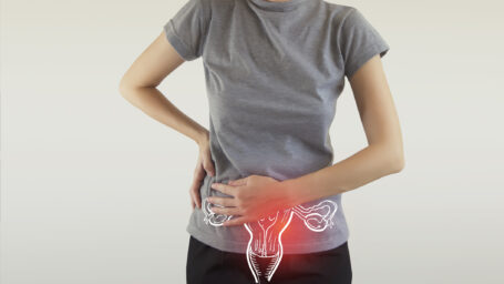 Ovarian Cancer