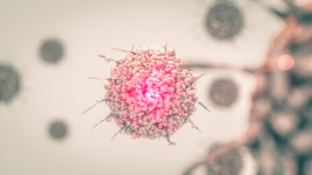 Myeloma Treatment
