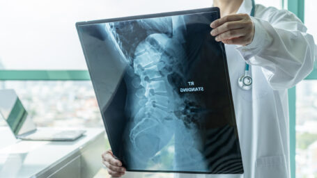Bone Cancer