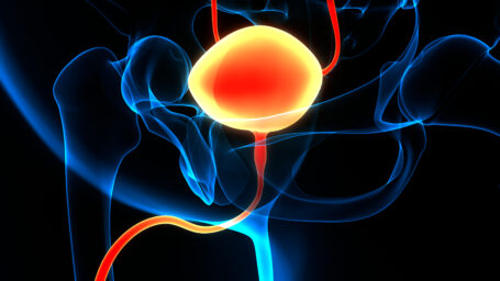 Bladder Cancer Screening