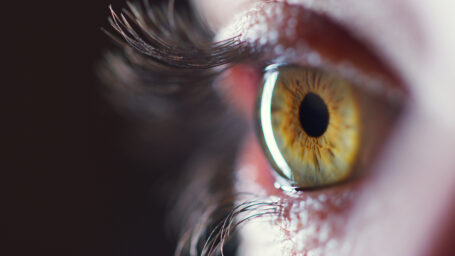 Cornea and External Disease