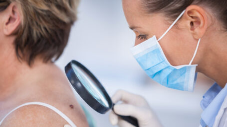 Doctor checking a patient for skin cancer