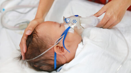 Baby with RSV
