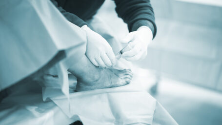 ankle arthroscopy