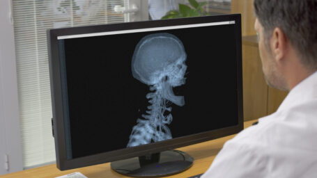 Mature doctor examining medical x-ray report on computer in clinic.
