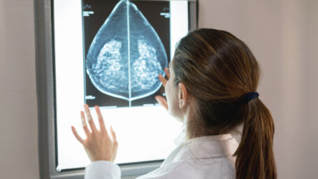Unrecognizable female gynocologist looking at a patients mammogram at the hospital