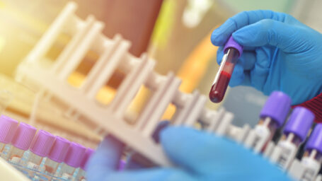 Blood samples in a tube being sent off for testing